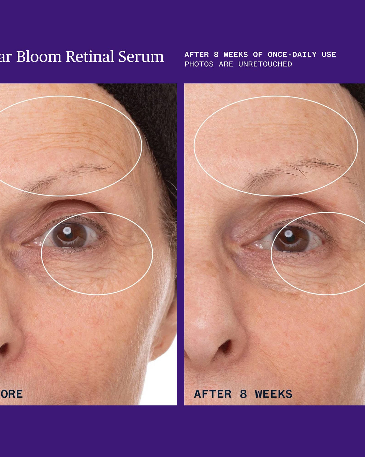 Before and after comparison of Lunar Bloom Retinal Serum on a person's face.